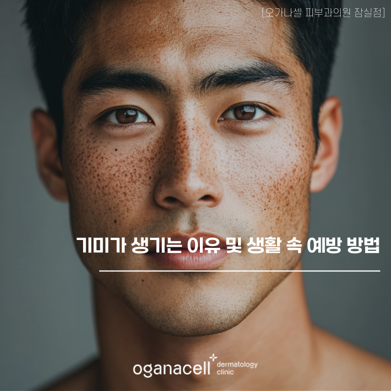 기미가 생기는 이유 및 생활 속 예방 방법 관련 이미지 1