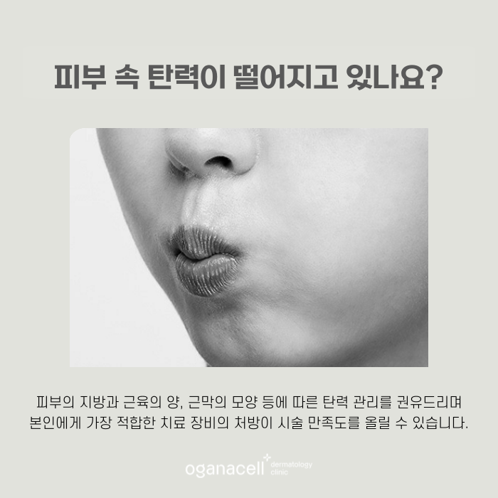 살 없는 얼굴 써마지 FLX 좋은 점 관련 이미지 6
