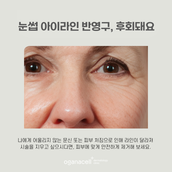잠실역1번출구 문신제거 잘하는 곳 관련 이미지 4