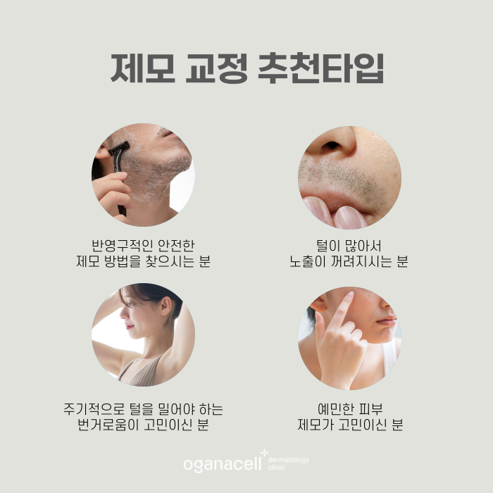 수염 등 제모하기 전에 알아두면 좋은 꿀팁 관련 이미지 5