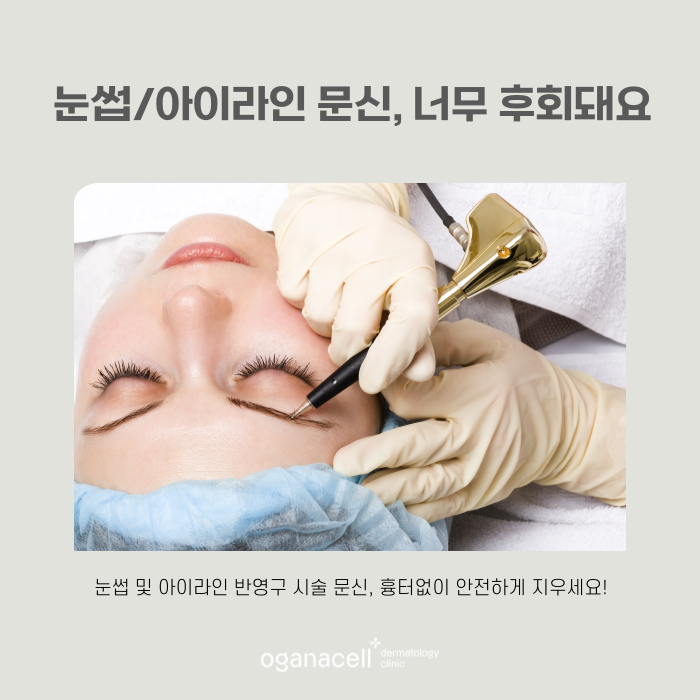 안전하게 문신제거하는 법 관련 이미지 6
