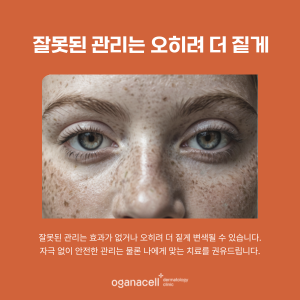 기미 고민 재발방지관리 중요합니다 관련 이미지 5