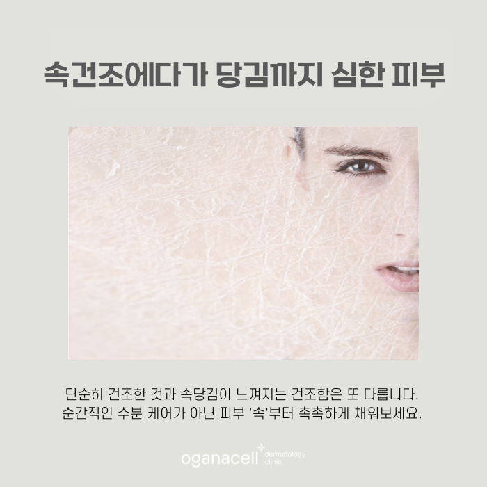잠실 리쥬란 잘하는 곳 관련 이미지 5