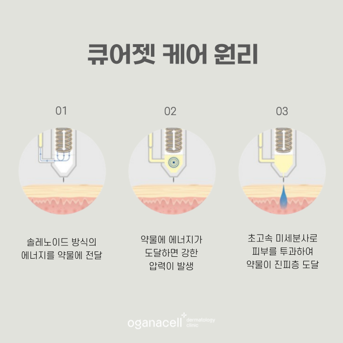 잠실큐어젯 흉터교정 방법 관련 이미지 5