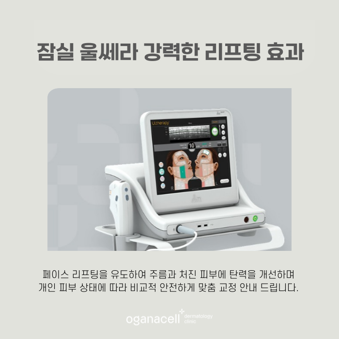 잠실 울쎄라 장단점 알아야 하는 이유 관련 이미지 5