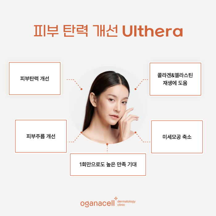 잠실 울쎄라 400샷 600샷 고민될 때 관련 이미지 5
