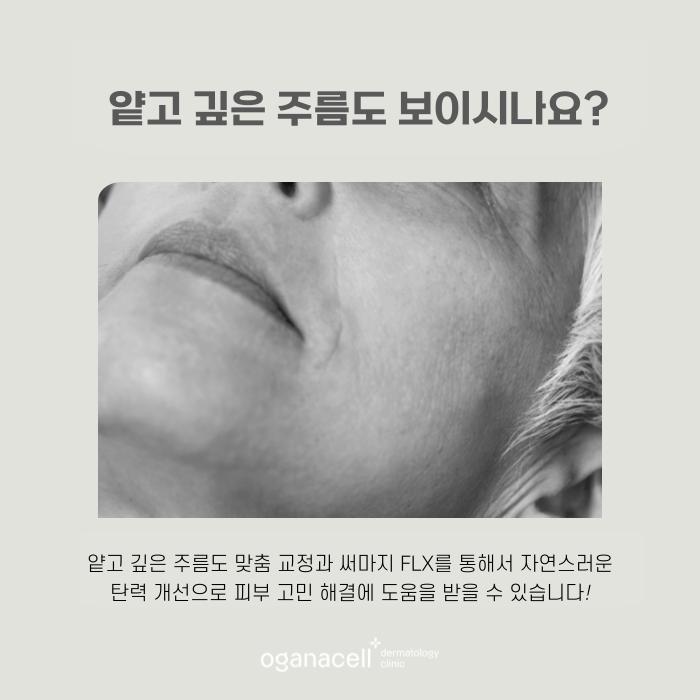 살 없는 얼굴 써마지 FLX 좋은 점 관련 이미지 5