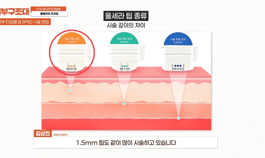 잠실 울쎄라피 프라임 피부과 효과 보는 방법 관련 이미지 8