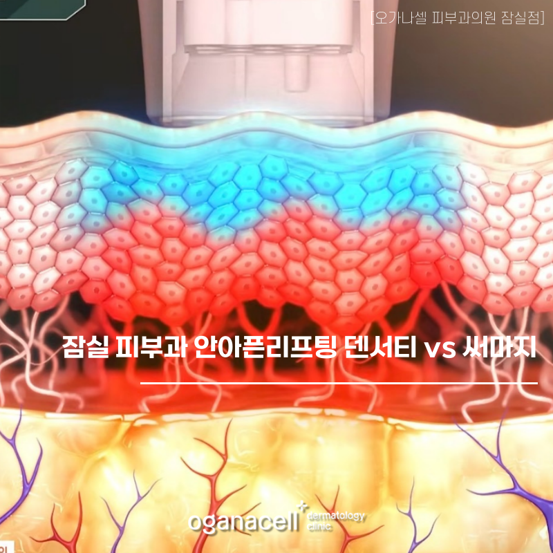 Jamsil Dermatology Clinic: Low-Pain Lifting—Density vs. Thermage image 1
