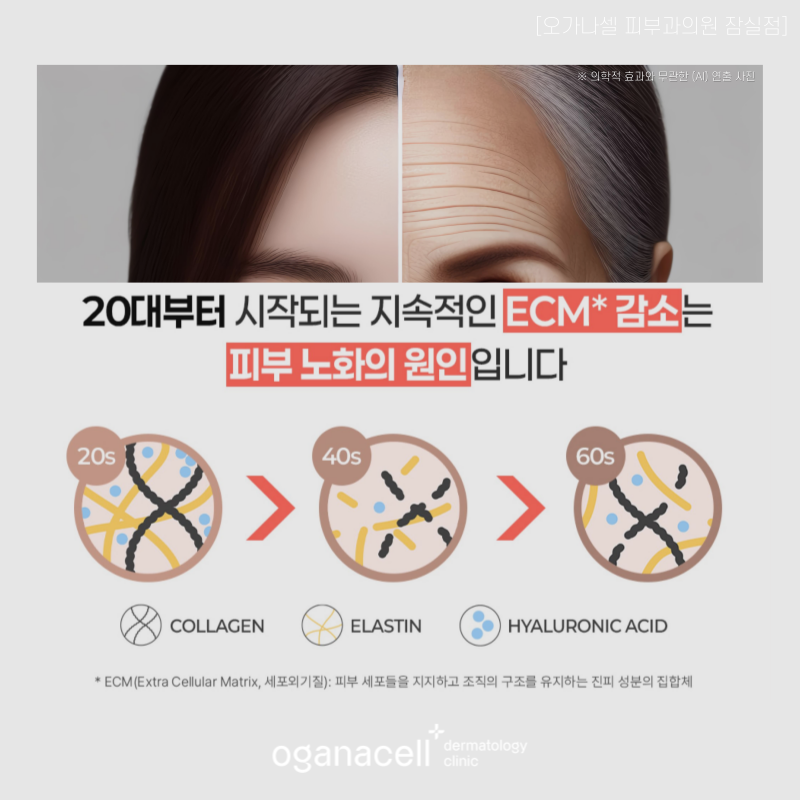 신청동피부과 잘하는 곳 엘라비에 리투오 정보 관련 이미지 2
