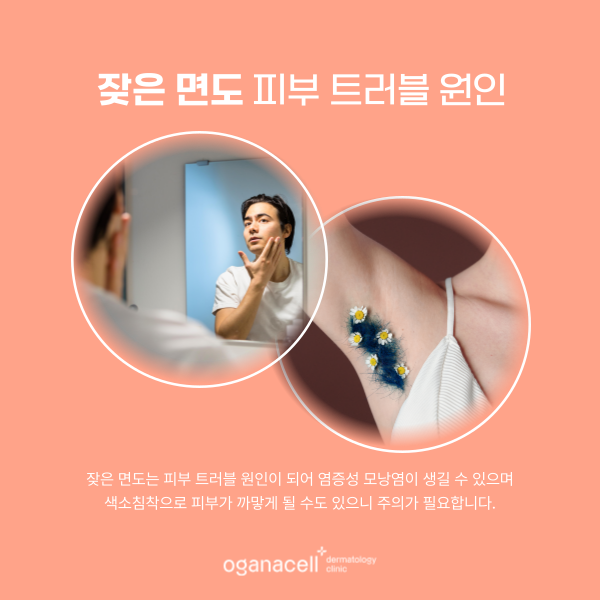 잠실역제모 여름준비 겨드랑이 등 관리법 관련 이미지 4