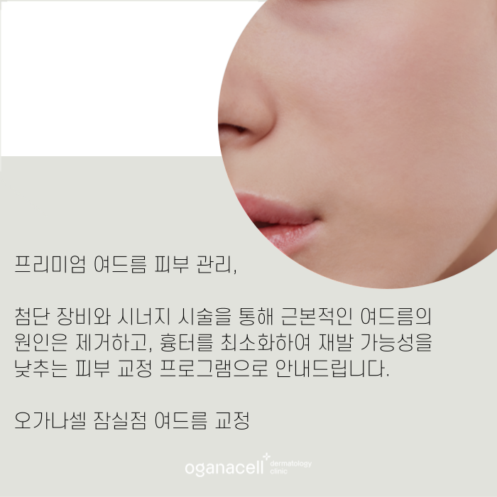 얼굴 트러블 원인 제거해서 해결해 주는 잠실피부과 관련 이미지 11