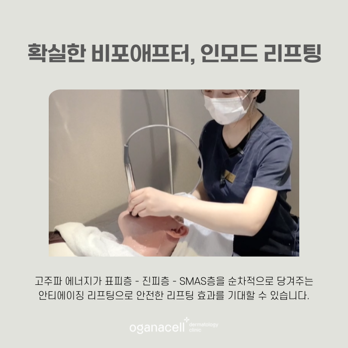 잠실인모드 유지기간 및 주의점 관련 이미지 6