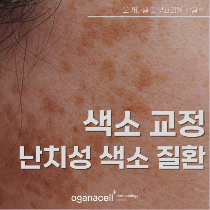 얼굴모반 우리아이한테도 보인다면 관련 이미지 1