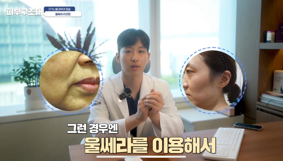 잠실울쎄라 잘하는 곳 관련 이미지 11