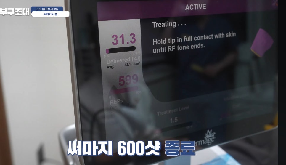 잠실써마지 600샷 실제 관리 후기 장면 다시보기 관련 이미지 19