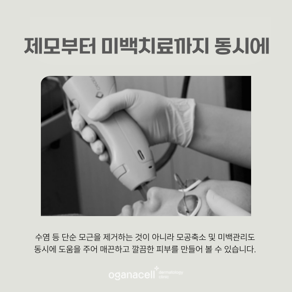 남자수염제모 깨끗하게 잘하는 잠실피부과 관련 이미지 6