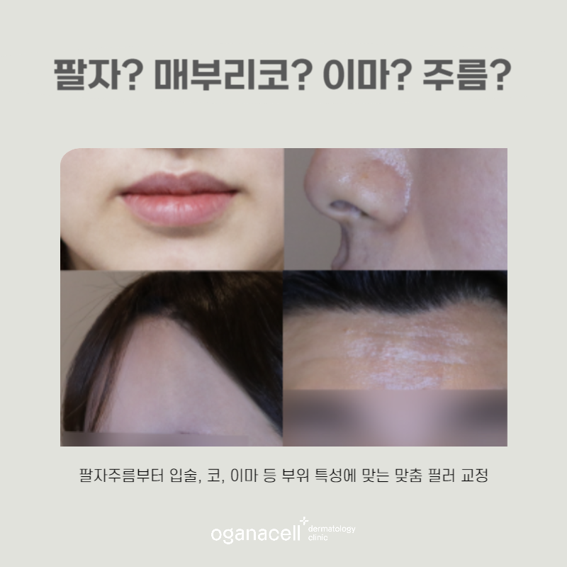 얼굴볼륨 하나로 어려 보이는 방법 관련 이미지 7