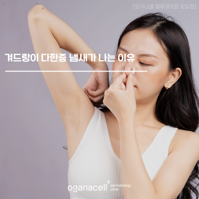 겨드랑이 다한증, 냄새가 나는 이유가 뭘까? 관련 이미지 1