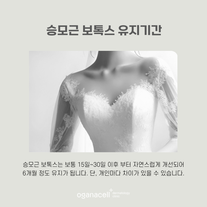 승모근 보톡스 효과 및 유지기간 관련 이미지 6