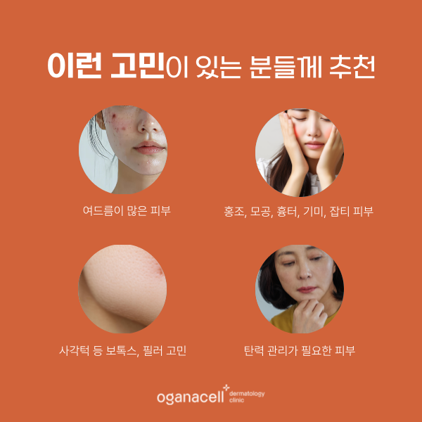 잠실 수험생 할인 이벤트 피부과 관련 이미지 4