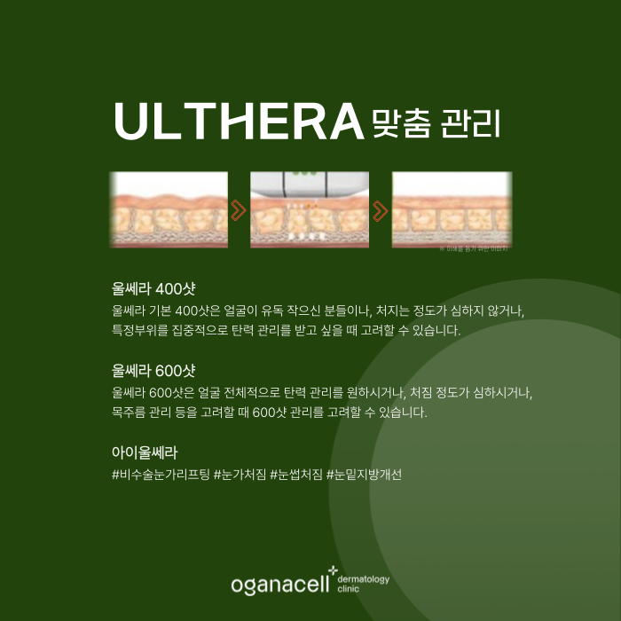 잠실역 피부과 울쎄라 적용부위 등 알아보기 관련 이미지 6