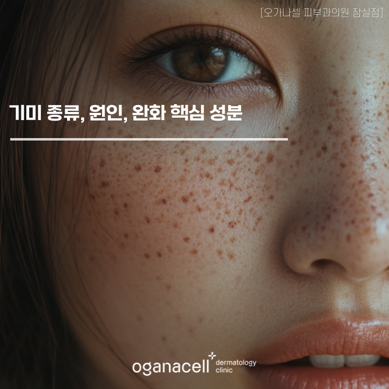 기미 종류, 원인, 완화 핵심 성분 관련 이미지 1