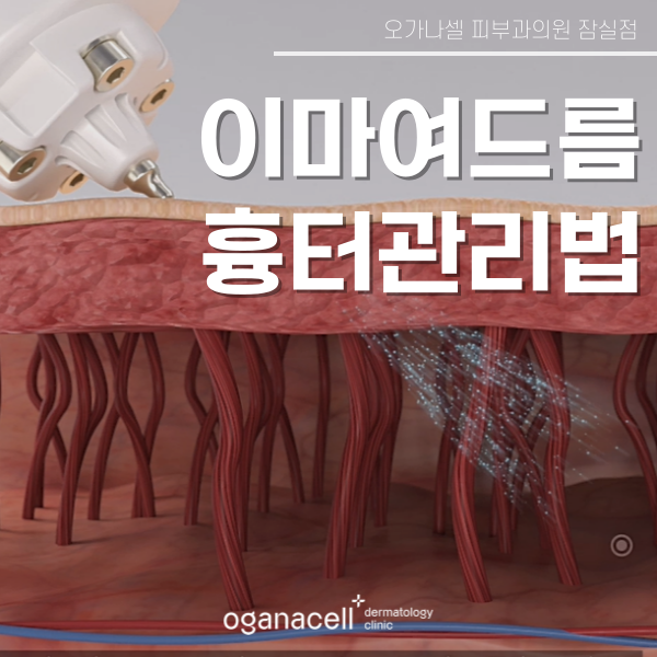 이마여드름흉터 개선 - 잠실피부과 관리법 관련 이미지 1