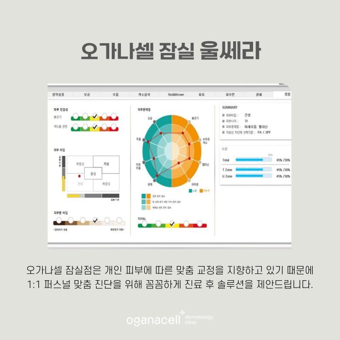 잠실 울쎄라 장단점 알아야 하는 이유 관련 이미지 7