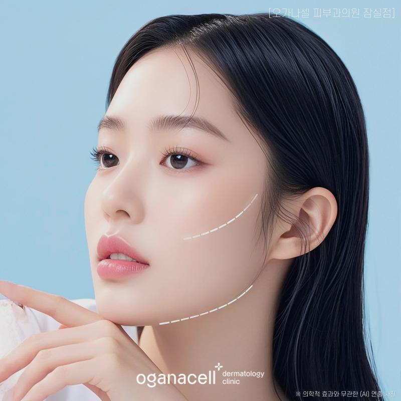 잠실 써마지 가격 ? 600샷 영상부터 보세요 ! 관련 이미지 3