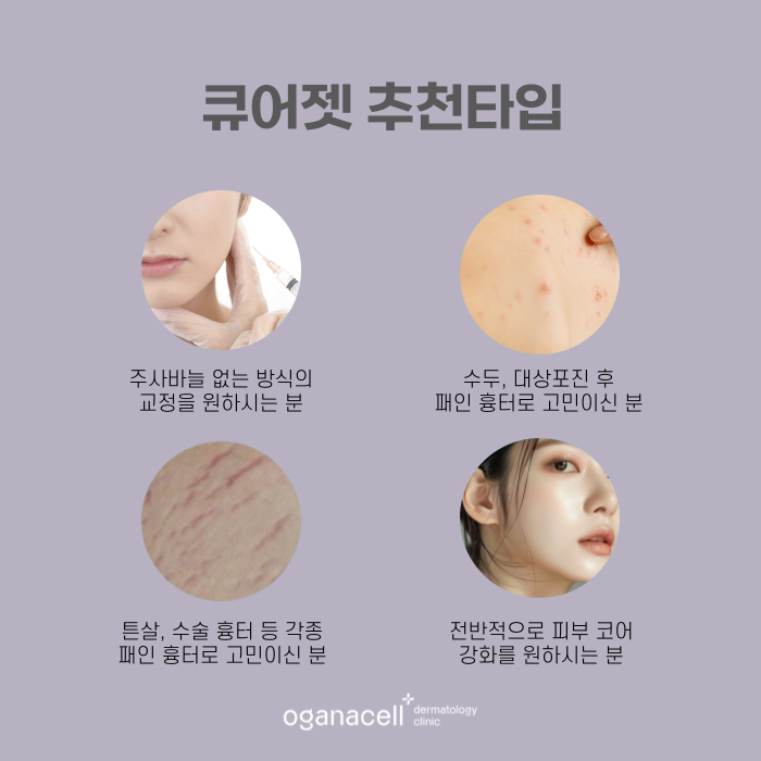 잠실 큐어젯 있는 피부과 관련 이미지 4