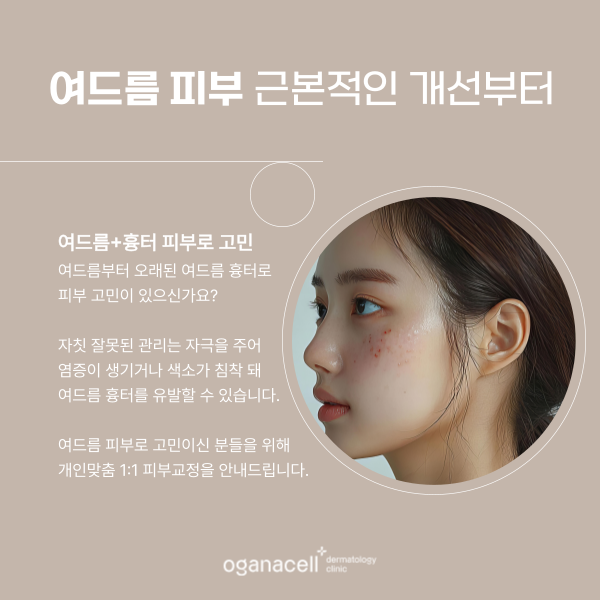 잠실 피부과여의사 피부과 전문의 이현수 원장님 예약안내 관련 이미지 6