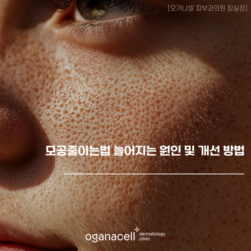 모공줄이는법 늘어지는 원인 및 개선 방법 관련 이미지 1