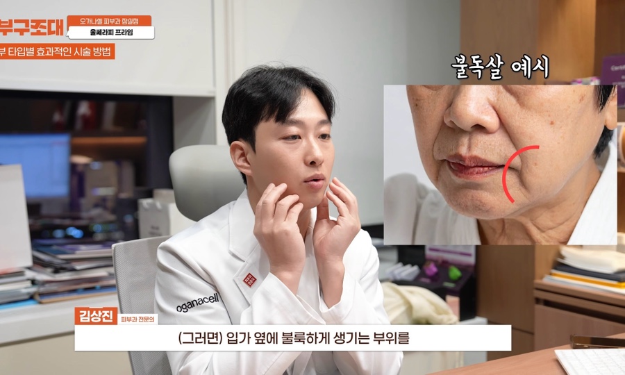 잠실 울쎄라피 프라임 피부과 효과 보는 방법 관련 이미지 10