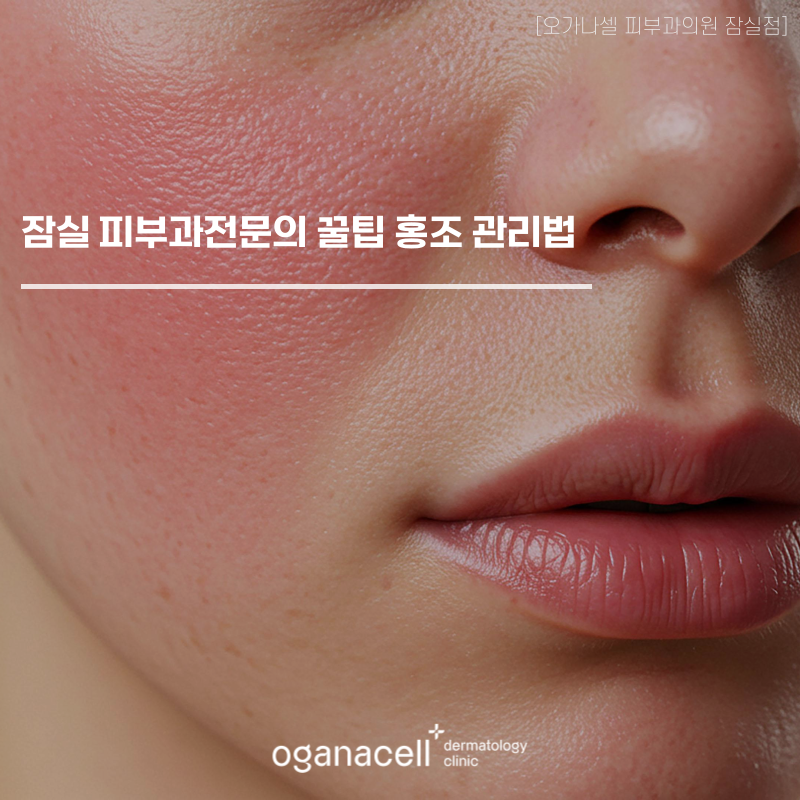 잠실 피부과전문의 꿀팁 홍조 관리법 (환절기/겨울철) 관련 이미지 1