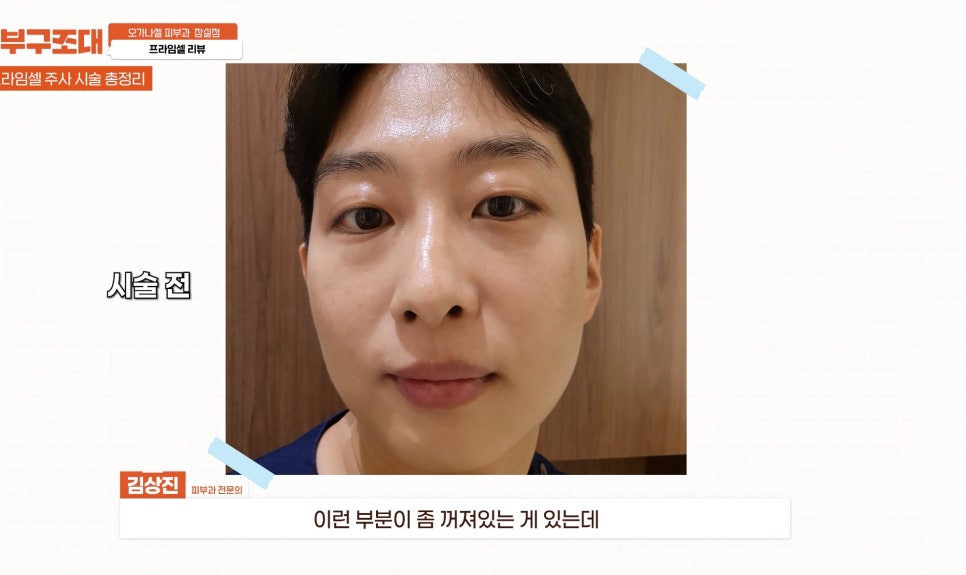 연예인피부관리 프라임셀 직접 해 본 후기 관련 이미지 9