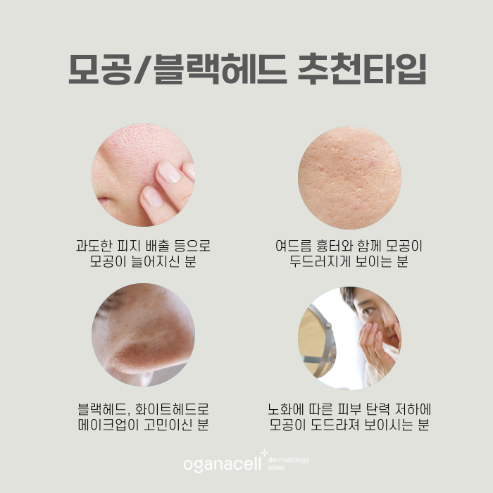 모공 줄이는 법, 커지는 원인부터 알아야 합니다 관련 이미지 5