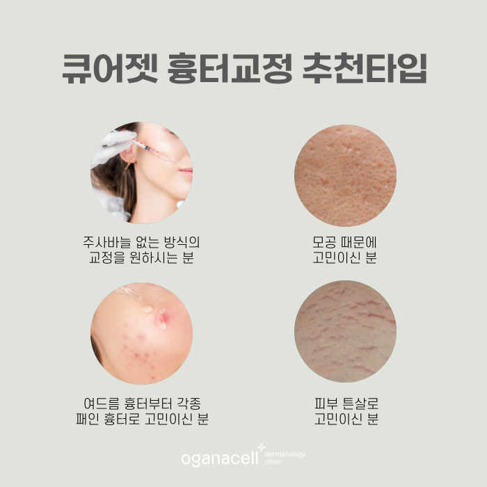 잠실큐어젯 흉터교정 방법 관련 이미지 4