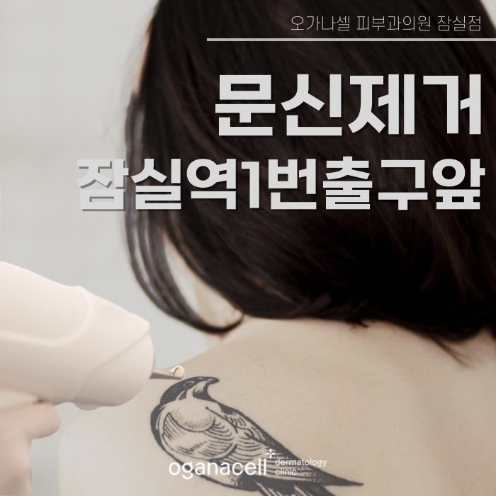 잠실역1번출구 문신제거 잘하는 곳 관련 이미지 1