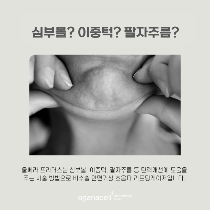 피부 초음파 목관리도 할 수 있는 잠실울쎄라 관련 이미지 5
