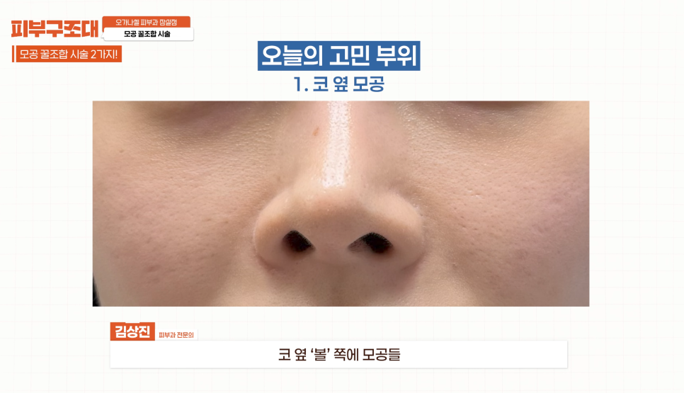 모공 포텐자, 함께 받으면 좋은 잠실피부과 관리 1가지 관련 이미지 2
