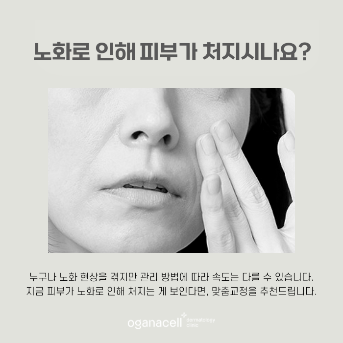 살 없는 얼굴 써마지 FLX 좋은 점 관련 이미지 4