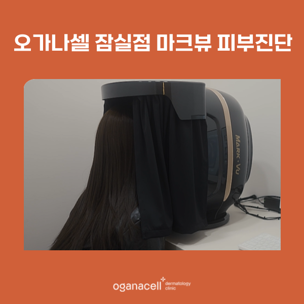 마크뷰피부진단 받을 수 있는 방법 관련 이미지 2