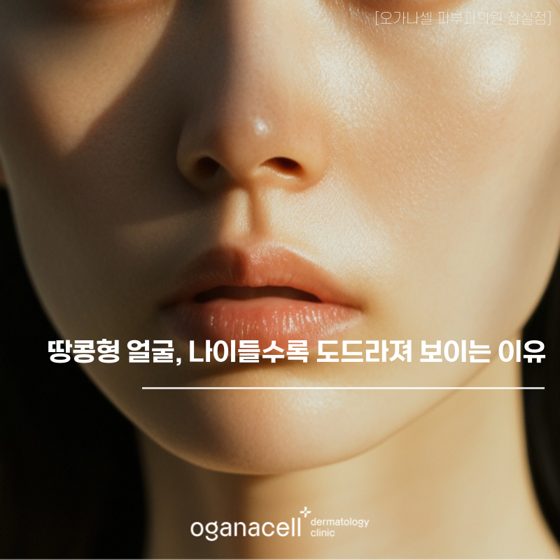 땅콩형 얼굴, 나이들수록 도드라져 보이는 이유 관련 이미지 1