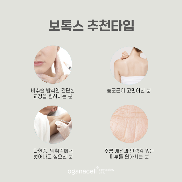 잠실역보톡스 유명한 곳 관련 이미지 3