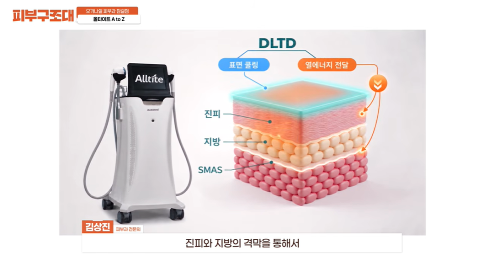송파 잠실 피부과, 올타이트 리프팅 오해와 특징은? 관련 이미지 3