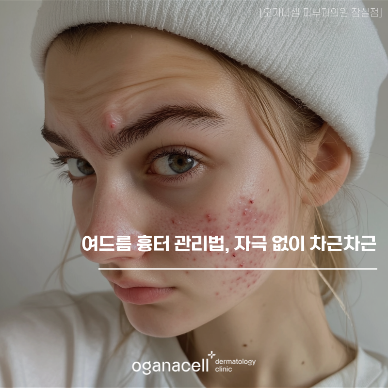 How to Care for Acne Scars, Step by Step Without Irritation image 1