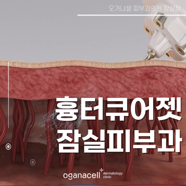 롯데월드타워피부과 흉터 관리 잘하는 곳 관련 이미지 1