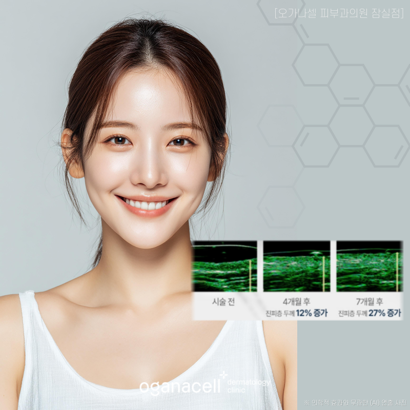 잠실 레디어스 콜라겐주사 원리 효과 정보 관련 이미지 4