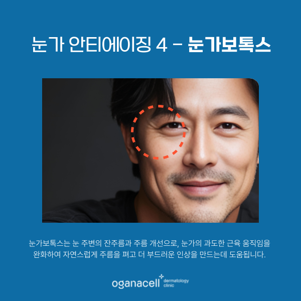 눈가주름없애는법 4가지 - 아이울쎄라 아이리쥬란 아이써마지 눈가보톡스 관련 이미지 7
